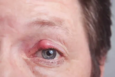 Крем-флюид для контура глаз Evereco Терминалия + Лецитин - «Летом совсем не  хочется подвергать кожу испытаниям с аллергией, но с этим кремом-флюидом  иначе никак. Я игнорировала первые признаки неподошедшего состава, но через