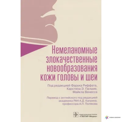 Раскрыты пять неожиданных симптомов рака кожи: 17 марта 2023, 09:50 -  новости на Tengrinews.kz