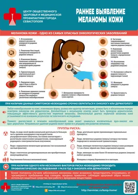 Меланома: симптомы и профилактика рака кожи - 15 июня, 2023 Статьи «Кубань  24»