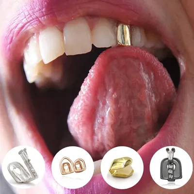 Золотые коронки зубов над природными зубами. С медицинской точки зрения  точной иллюстрацией 3d человеческих зубов Иллюстрация штока - иллюстрации  насчитывающей подготовка, защитите: 180480834