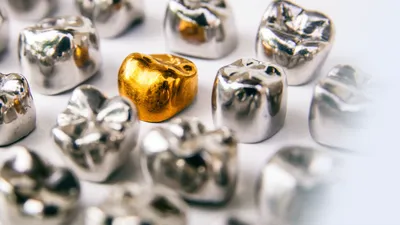 Скупка стоматологического золота в Санкт-Петербурге | Продать золотые  коронки по высокой цене за 1 грамм