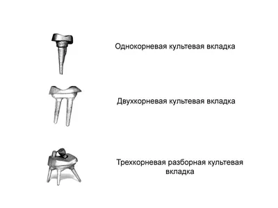 Восстановительная керамическая вкладка E-max на зуб недорого в Москве, цена  под ключ