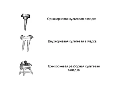 Удлинение коронки зуба