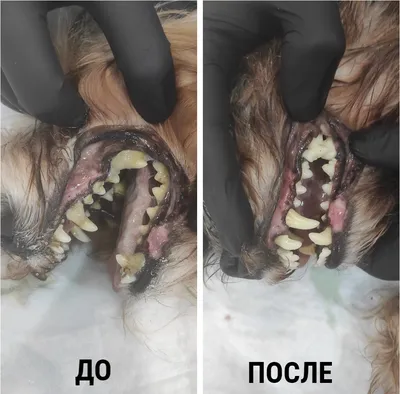 Жалобы на зубной камень, как следствие неприятный запах изо рта, фото до и  после