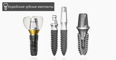 Виды имплантов зубов: описание, плюсы и минусы зубных имплантов –  стоматология Президент