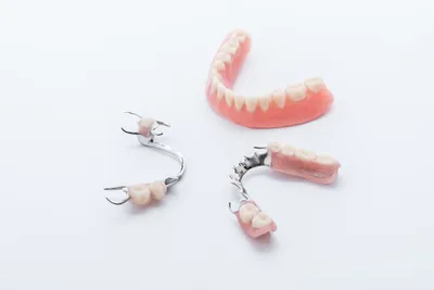 Съемные зубные протезы без неба - цена в Москве, установить съемные зубные  протезы без неба в стоматологии Альфа-Клиник