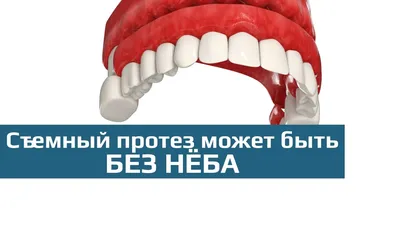 Съемные зубные протезы: съемный зубной протез sandwich (сендвич) - YouTube