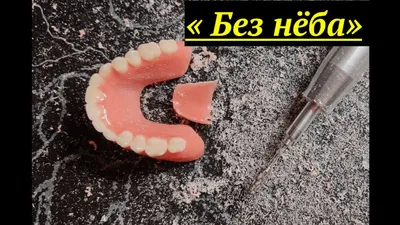 Частичный Пластиночный Съёмный Зубной Протез. Лазердент Хабаровск. Цена