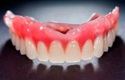Полные съемные протезы Acry Free - «Институт здоровья зубов»