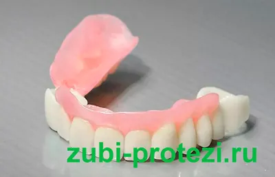 Виды зубных протезов без нёба, удобные съёмные протезы