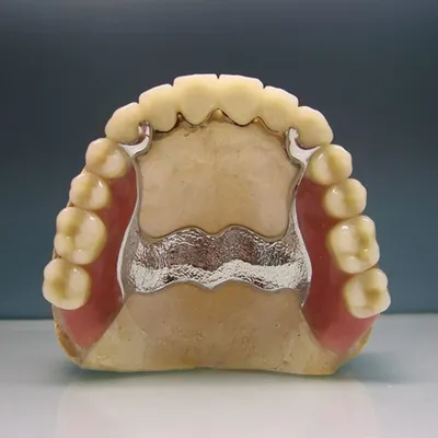 Зубные протезы без неба. Протезы нового поколения | Портал о зубах  Симпладент | Дзен