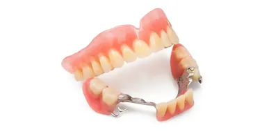 Зубные протезы без неба по доступной цене в стоматологии «Ортодонт-центр»