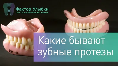 Бюгельные протезы зубов - цены в Санкт-Петербурге в стоматологии «Фактор  Улыбки»