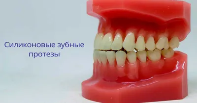 Силиконовые зубные протезы [отзывы, виды, плюсы, цена в Москве]