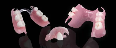 Частичный съемный зубной протез на крючках (кламмерах) - Центр приватной  стоматологии «Доктор Левин»