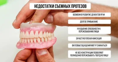 Съемные зубные протезы по низкой цене в Челябинске | Дента