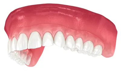 Бюгельный протез зубов — что это такое, виды, фото и уход за бюгельными зубными  протезами