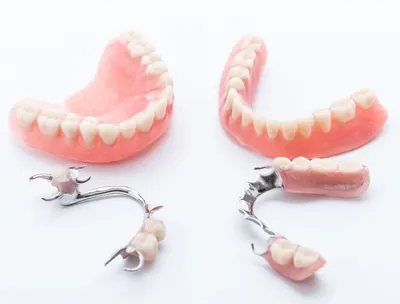 Съёмные протезы зубов виды и цены СПб - ProЗубы