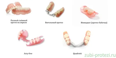 Съемные зубные протезы на имплантатах. Клиника профессора Абакарова