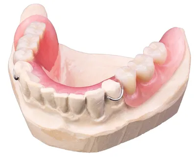 Съемные зубные протезы [виды, материалы, цены и уход]