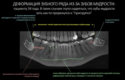 Связь зубов с организмом