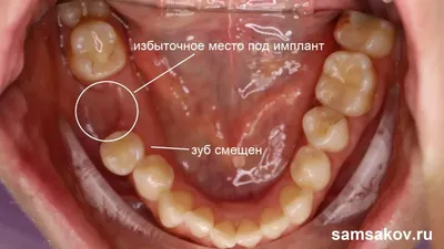 Когда меняются молочные зубы | Доктор Пломбин