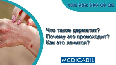 Зуд кожи во время беременности - Иркутский городской перинатальный центр  имени Малиновского М.С.